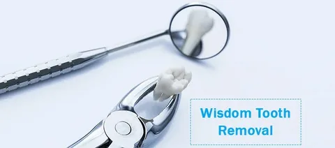 wisdom tooth removal insurance